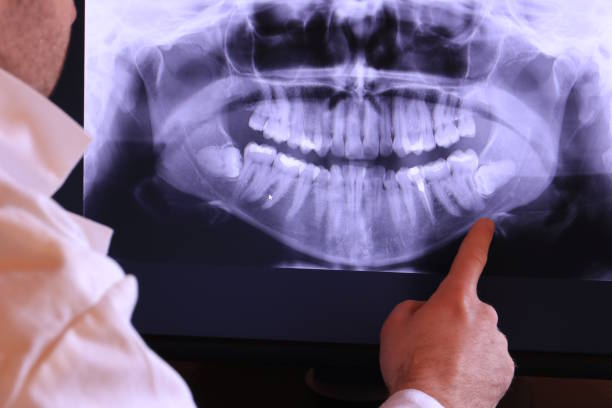 Best Orthodontic Emergency Dentist in Skidmore, TX